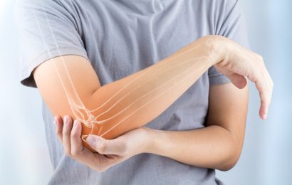 Bone glue repairs fractures in 3 minutes