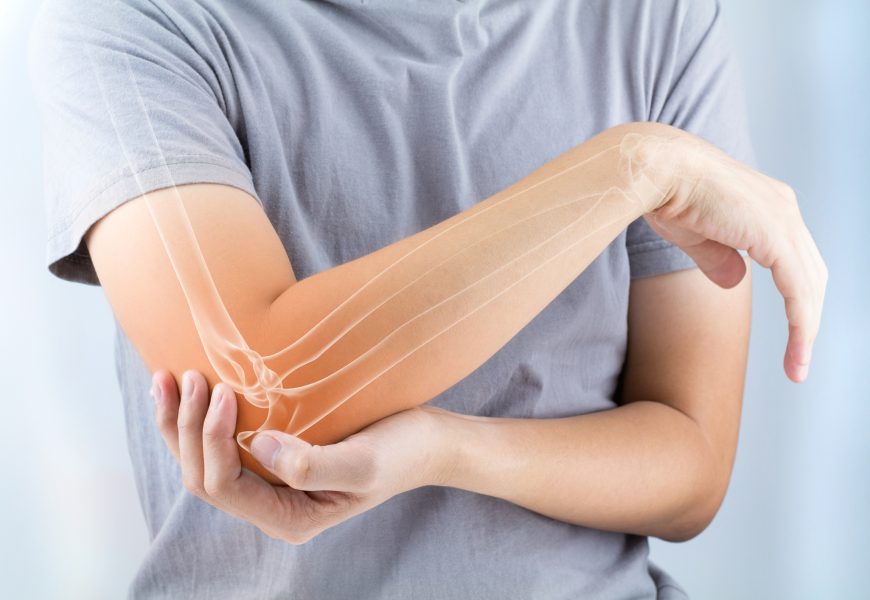 Chinese Researchers Unveil Bio-Glue That Heals Broken Bones in 3 Minutes