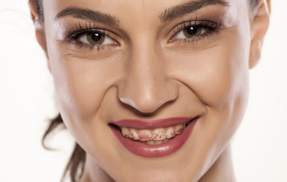 woman with lipstick on her teeth